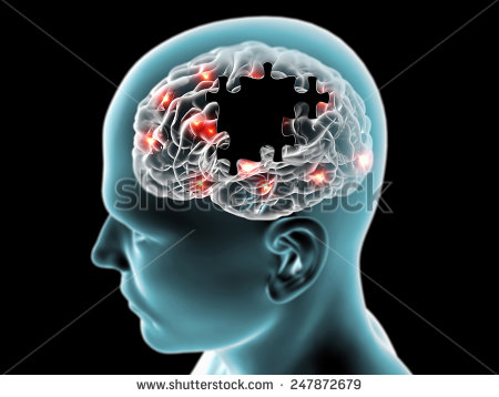 stock-photo-brain-degenerative-diseases-parkinson-alzheimer-puzzle-247872679